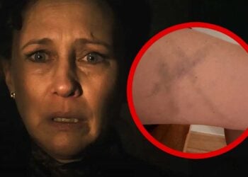 Vera Farmiga Cross Bruise The Conjuring Last Rites