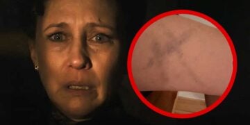 Vera Farmiga Cross Bruise The Conjuring Last Rites
